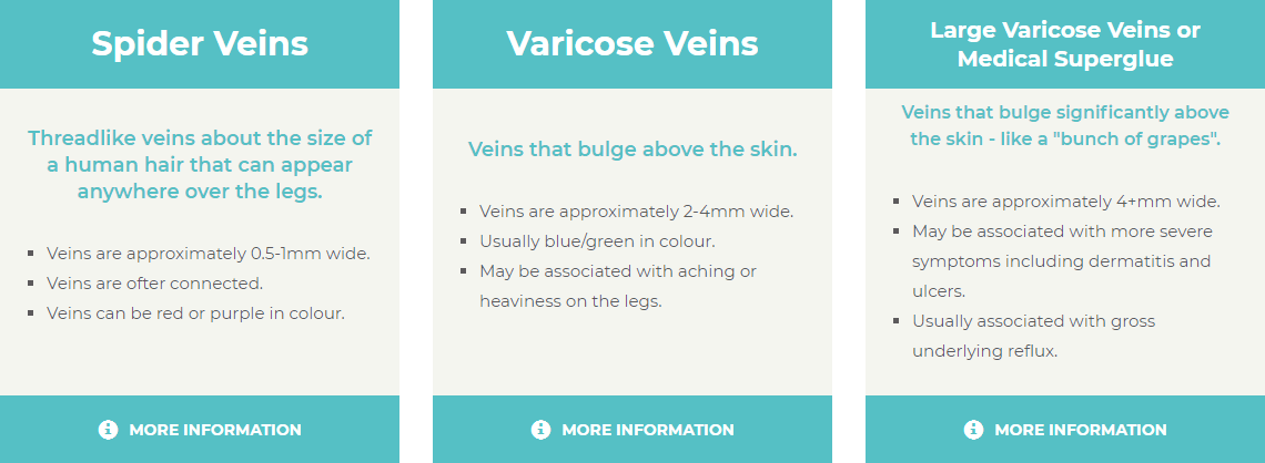 What sort of leg veins do you have?
